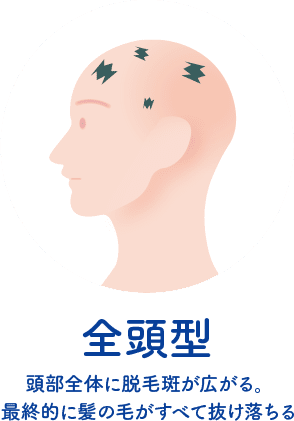 全頭型