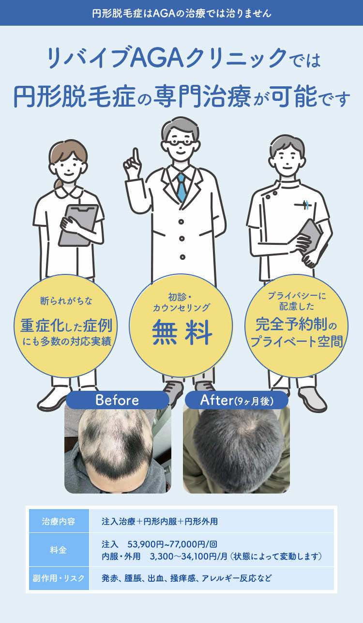 リバイブAGAクリニックでは円形脱毛症の専門治療が可能です