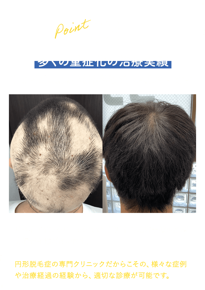 ポイント２　多くの重症化の治療実績　重症化した患者様も多数受け入れています